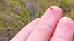 Experts say COVID-19 could lead to more tick-borne illnesses