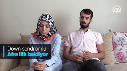 Down sendromlu minik Afra ilik bekliyor