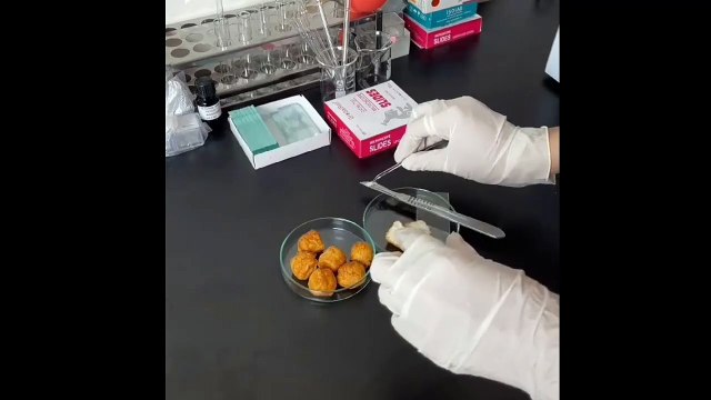 Đừng nghĩ cá viên chiên qua dầu sôi là an toàn