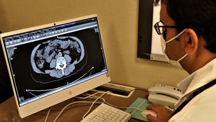 Uzmandan korkutan uyarı: Koronadan sonra kanser pandemisi bizi bekliyor