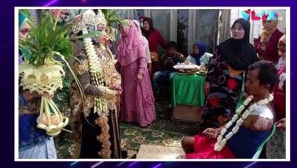Mempelai Pria Tampil Penuh Luka Saat Resepsi Pernikahan