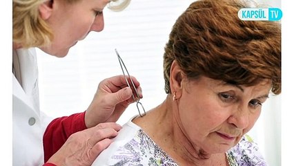 Vücuda tutunmuş kene durumunda ne yapılmalıdır?