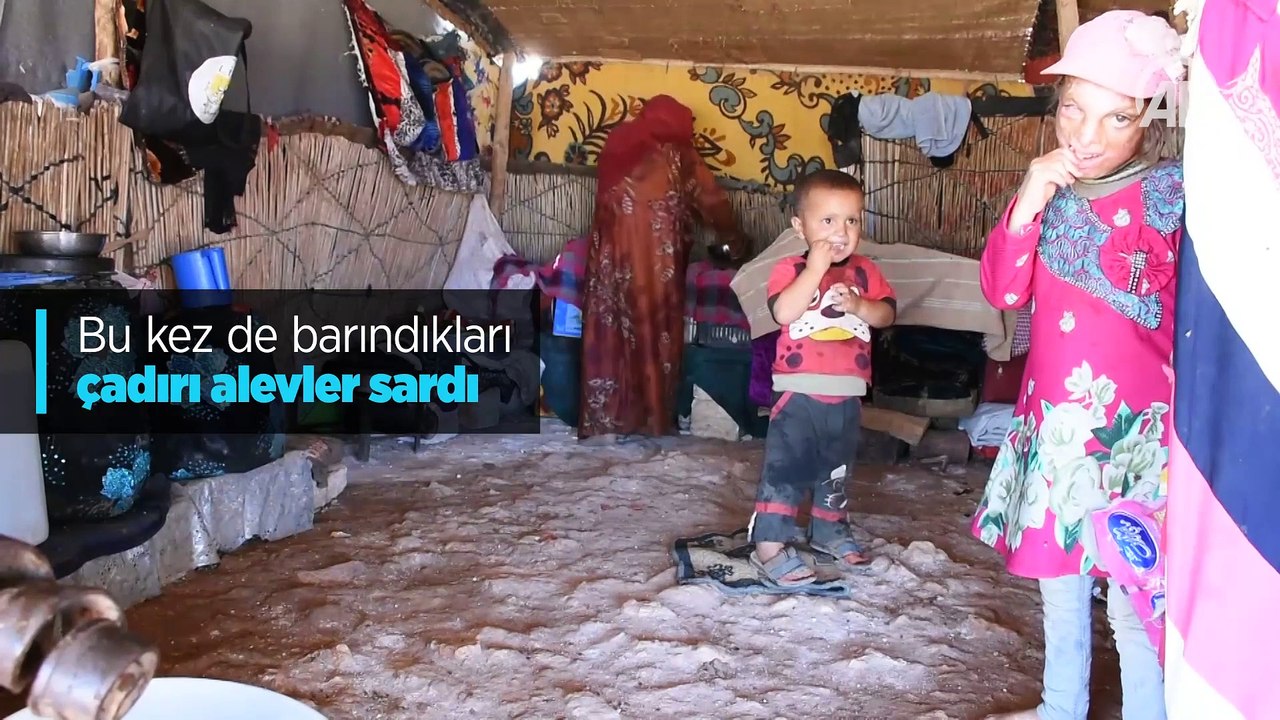 Yanık izleri yüzünden dışlanan küçük kız tedavi olmak istiyor