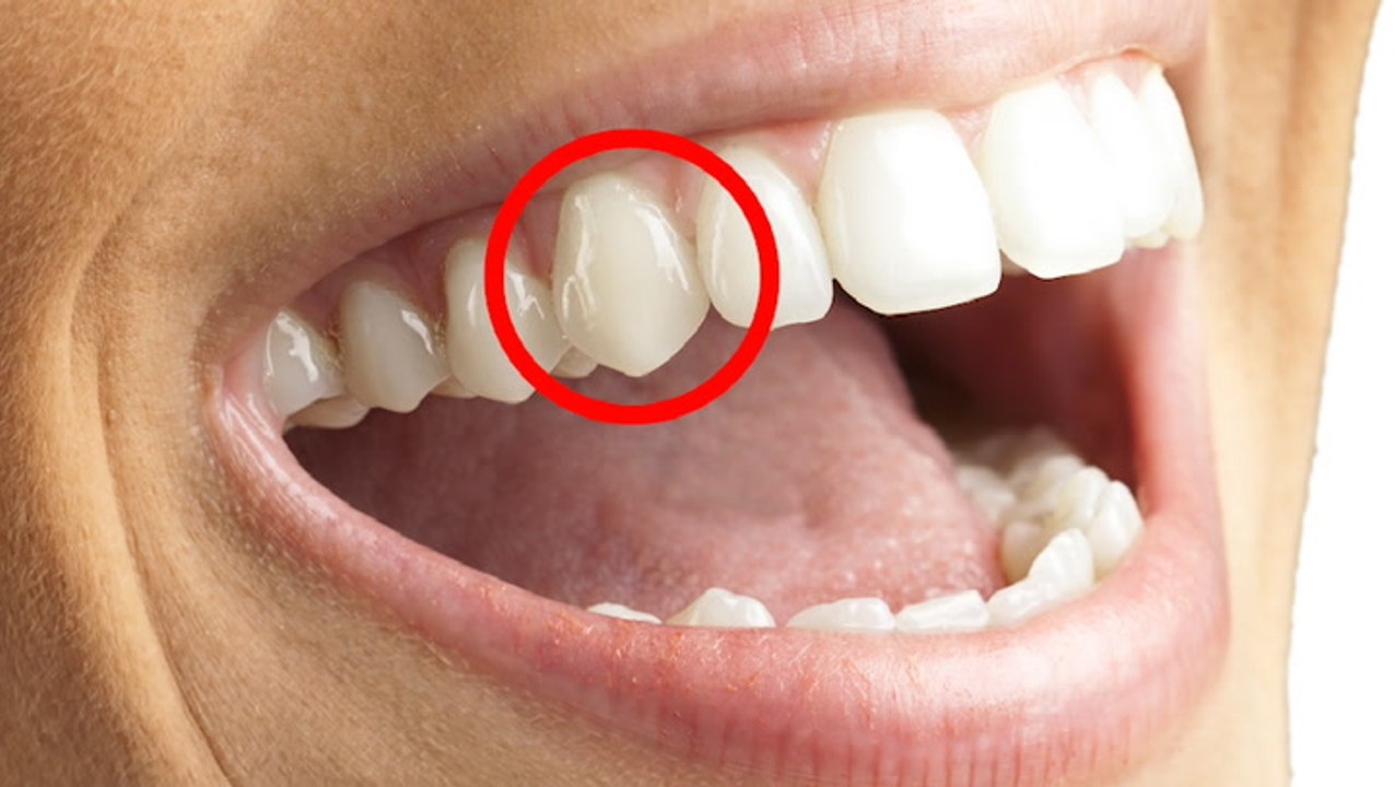 Why humans have sharp front teeth
