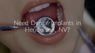 Joshua M. Ignatowicz, DMD - Dental Implants in Henderson NV