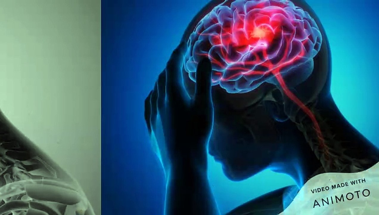Spore Focus Performance - Restores Your Memory