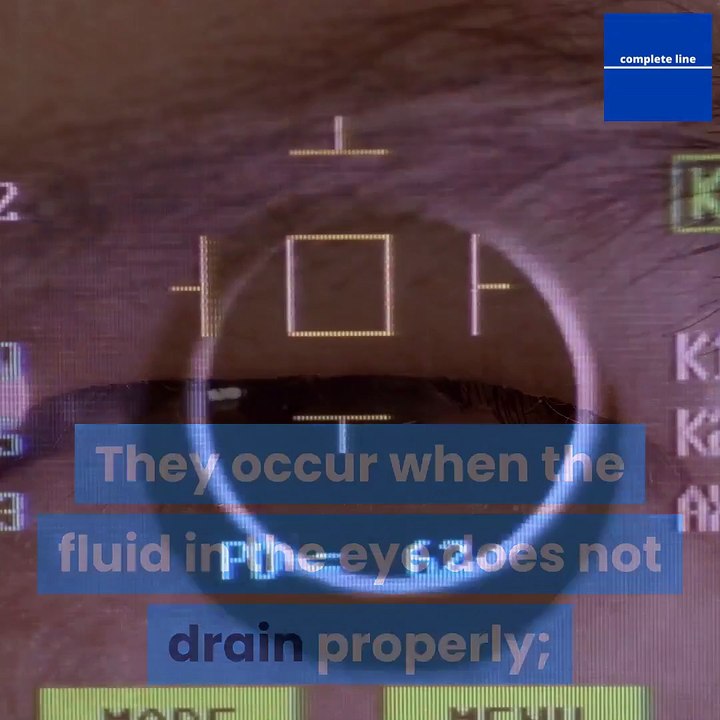 for-these-reasons-you-should-not-ignore-glaucoma