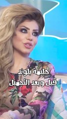 حليمة بولند قبل وبعد التجميل