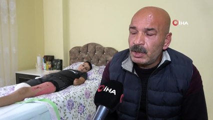 Kolları ve Sağ Bacağı Kesilen Furkan Dal Protez Kol ve Bacak İstiyor