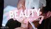 Botox Vs Fillers: What'S The Difference? | Beauty With Susan Yara