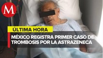 Se registró el primer caso de trombosis relacionado a la vacuna de Astra Zeneca en México