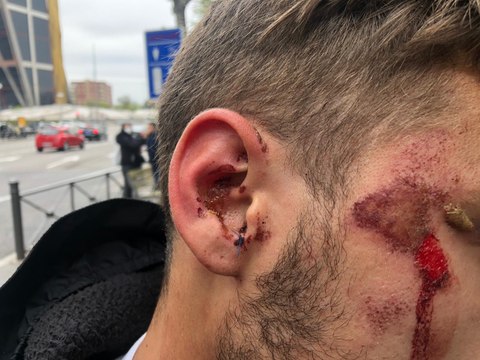 Momento de la detención de un joven en Vallecas durante la protesta contra el acto de la ultraderecha