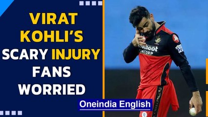 IPL 2021: Virat Kohli plays with swollen eye after a near-miss injury #RCBvsMI | Oneindia News