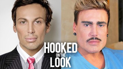 I've Been Botched - But I Won't Stop Getting Lipo | HOOKED ON THE LOOK