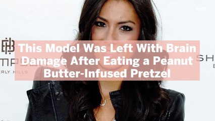 This Model Was Left With Brain Damage After Eating a Peanut Butter-Infused Pretzel—Here’s