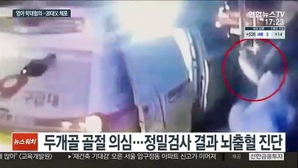 2개월 여아 한때 뇌출혈·심정지…20대 아빠 조사