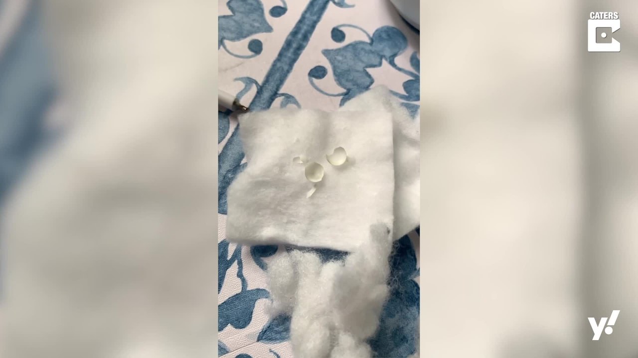 Überraschung: Frau brütet winzige Eier aus ...