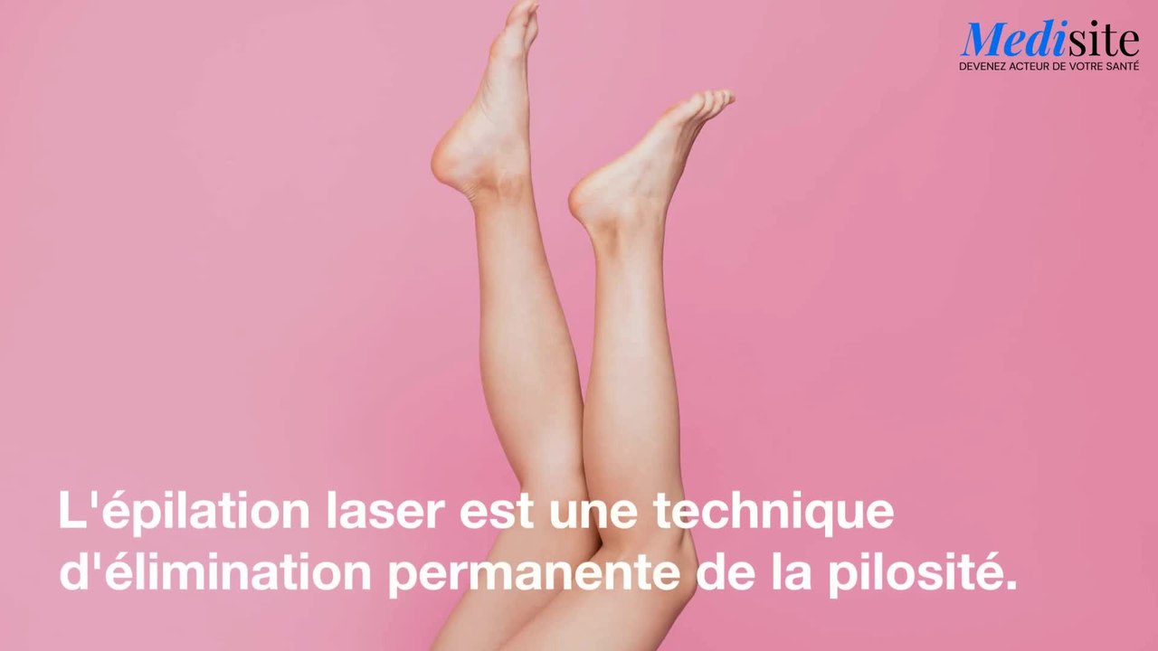 Epilation au laser : comment sa marche ?