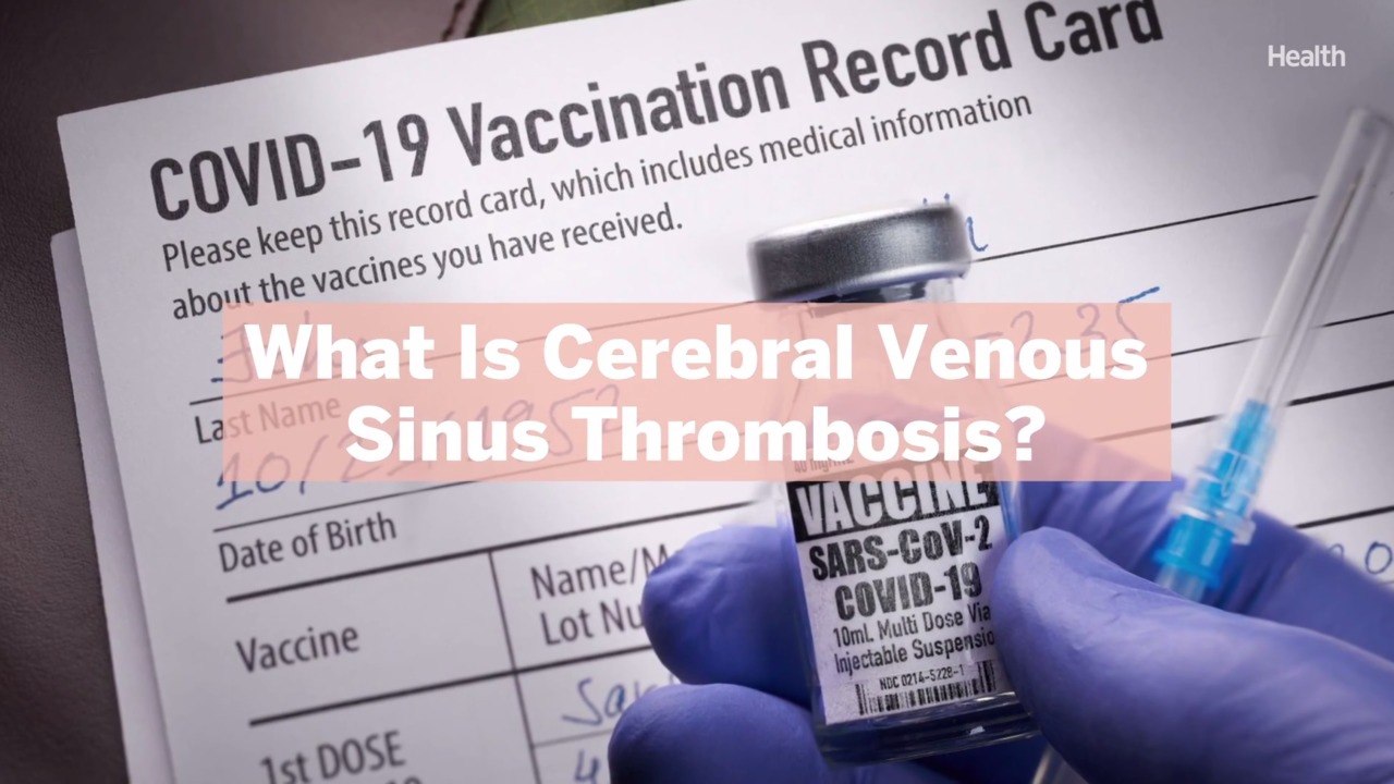 What Is Cerebral Venous Sinus Thrombosis? US Calls to Pause Johnson & Johnson Vaccine Over