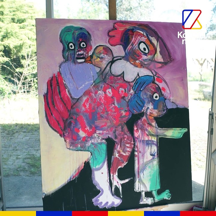 Amputée de 3 membres, je possède un bras bionique | REPORTAGE