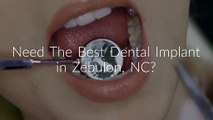 Tryon Family Dentistry : Dental Implant in Zebulon, NC