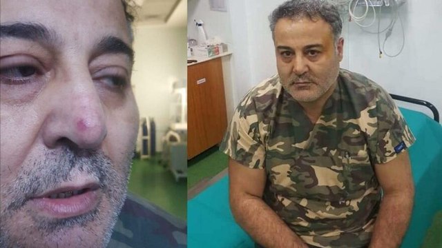 Doktora yumruklu saldırı