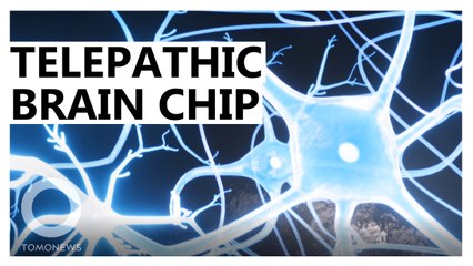 Elon Musk's Brain Implant:Here's How it Works