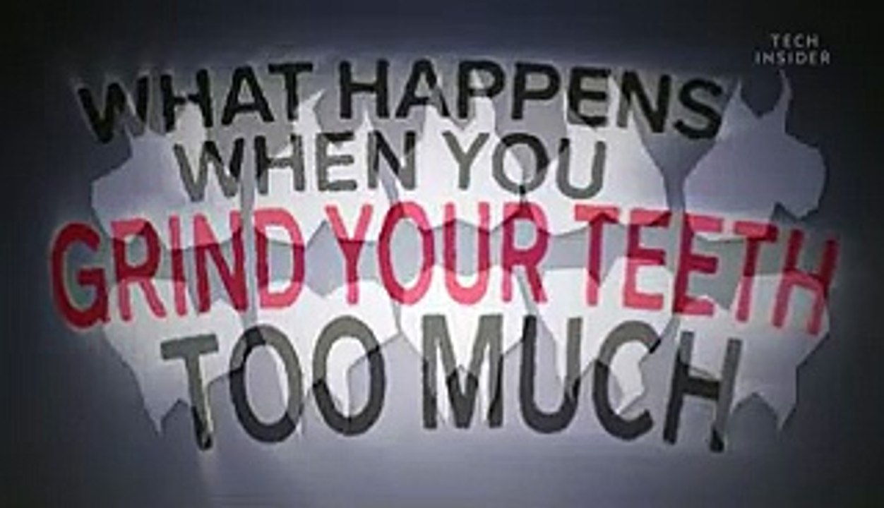 What happens if you grind your teeth too much video Dailymotion