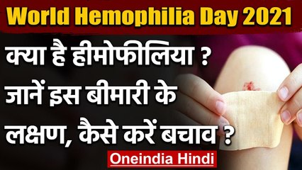 World Hemophilia Day 2021: क्या है हीमोफीलिया? जानें इस बीमारी के लक्षण और बचाव ? | वनइंडिया हिंदी