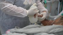 Los hospitales de Brasil recurren a la técnica  'manitas de amor' que son guantes de látex llenos de agua tibia