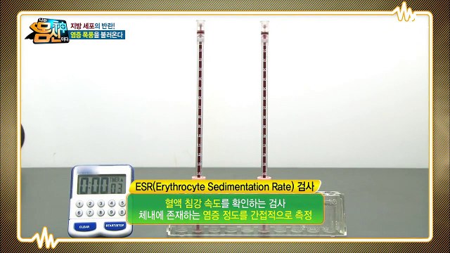 몸에 염증이 많으면 혈액을 무겁게 만든다? 몸신 가족의 염증 신호등!