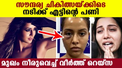 Actress Raiza wilson forced to undergo treatment and its went wrong