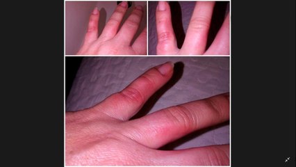 bd-enfermedades-reumaticas-200421