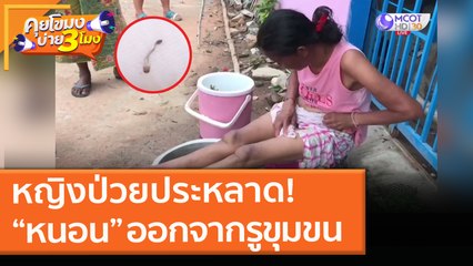 หญิงป่วยประหลาด! สัตว์คล้าย “หนอน” ออกจากรูขุมขน (20 เม.ย. 64) คุยโขมงบ่าย 3 โมง