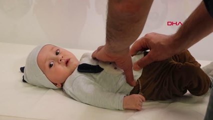 DENİZLİ 5 AY BAĞIRSAĞI DIŞARIDA YAŞAYAN EMİRHAN BEBEK SAĞLIĞINA KAVUŞTU