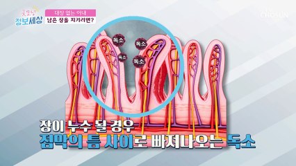 전신 건강을 해치는 장 독소!! 누수가 된다면?! TV CHOSUN 210421 방송