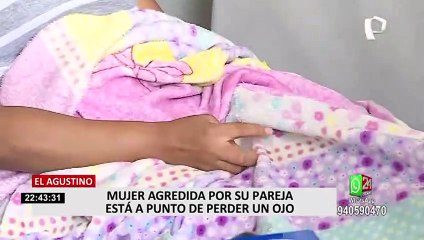 El Agustino: mujer agredida por su pareja está a punto de perder un ojo