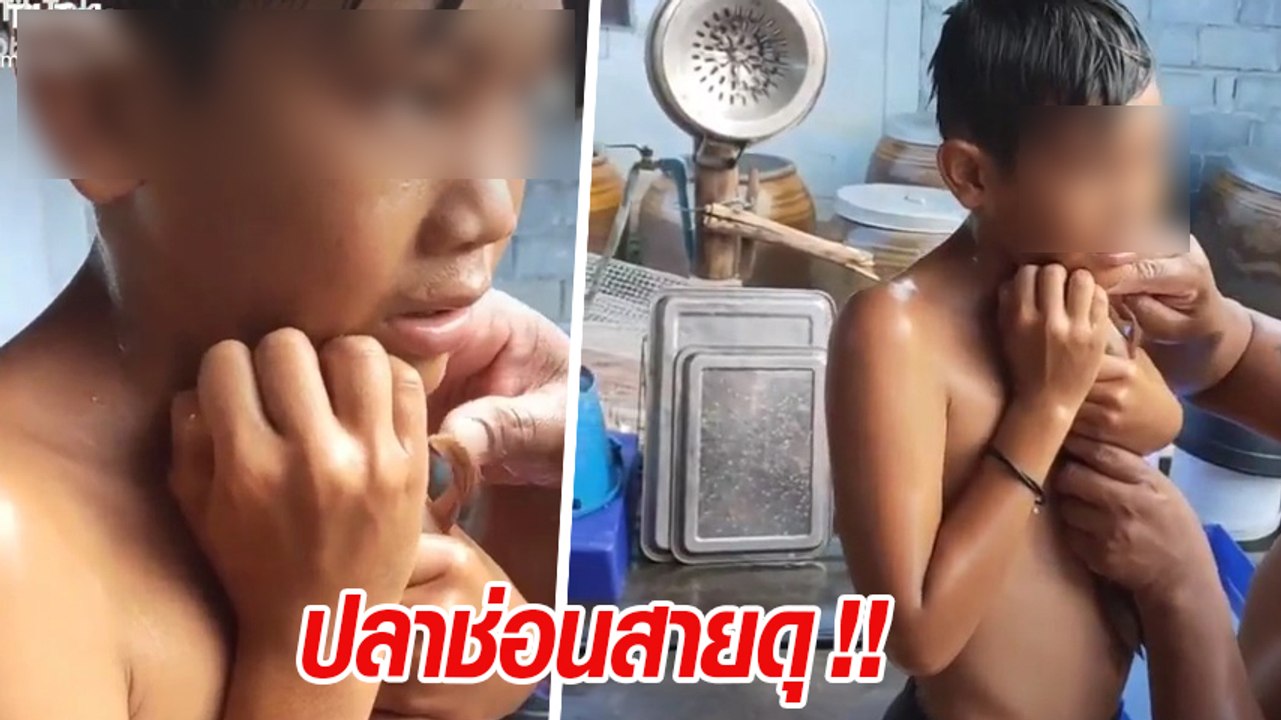 อุทาหรณ์ ! เด็กโชว์จูบกับปลาช่อน แต่โดนกระโดดกัดคอไม่ปล่อย ผู้ใหญ่ช่วยแกะอยู่นาน