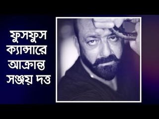 ফুসফুস ক্যান্সারে আক্রান্ত সঞ্জয় দত্ত  | Jagonews24.com