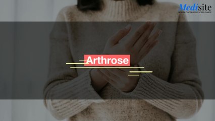 Arthrose : comment la prévenir ?