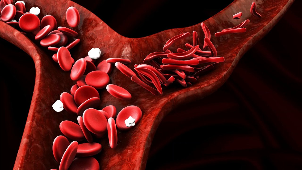 881/ 103Hz Anemia