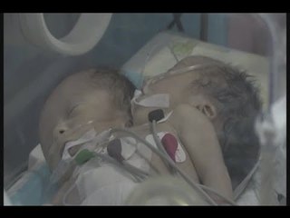 رأسان بجسد واحد! - حسن الجراح