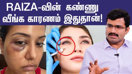 Facial treatments ஆபத்தா?  Raiza-க்கு என்ன ஆச்சு? | Doctor Explains About Cosmetic Procedures