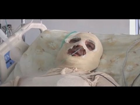 رئيس الشيشان يتدخل لمساعدة نازح سوري - نصري الرز