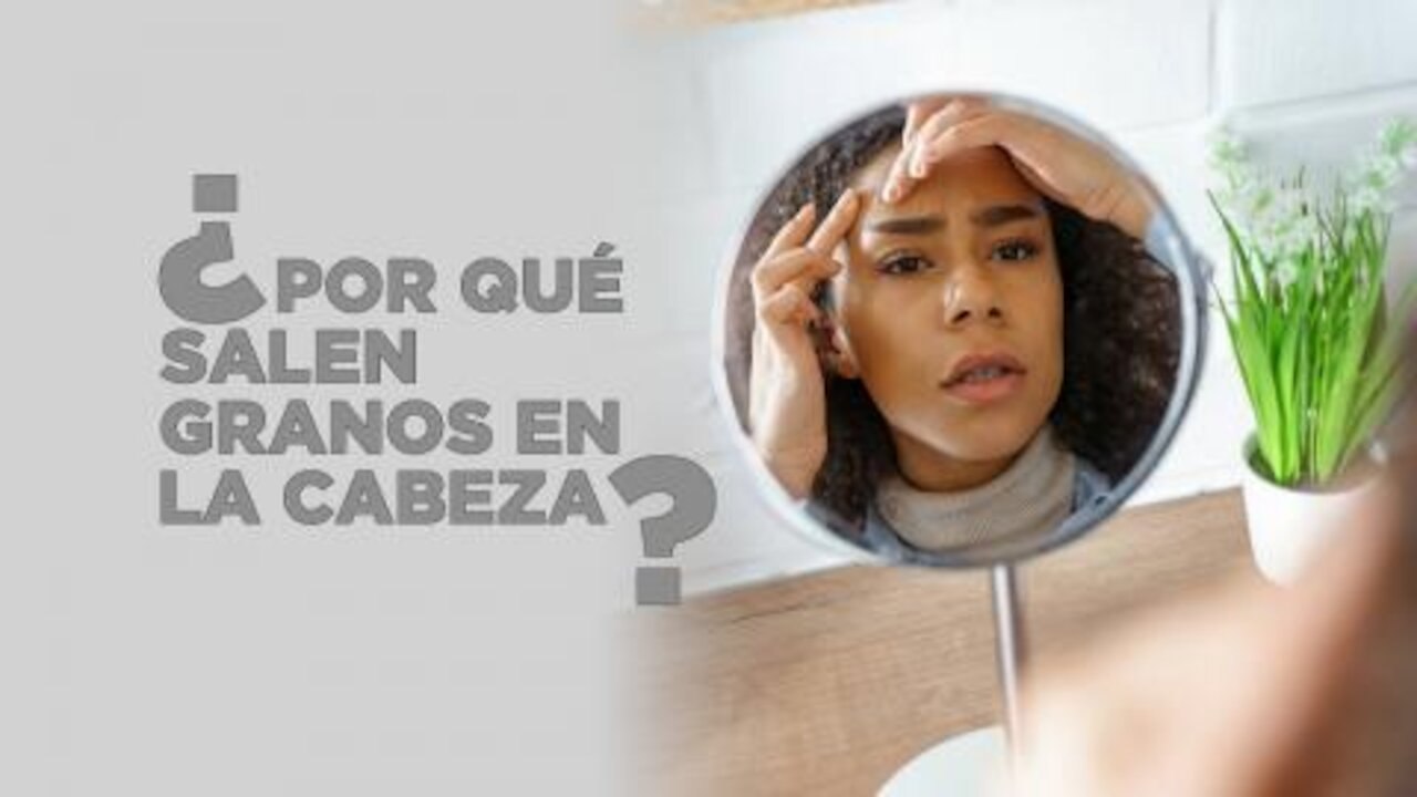 Por que salen granos en la cabeza | Salud 180