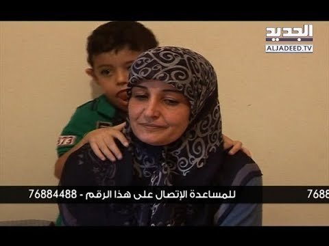 الكتل الكونية حال مرضية نادرة يعانيها الطفل محمد مهدي حسين.. ووالدته تناشد المساعدة - شوقي سعيد