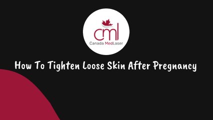How to tighten loose skin after pregnancy | Canada MedLaser Maple