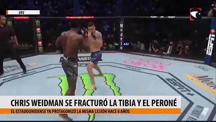 Chris Weidman se fracturó la tibia y el peroné