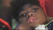 Cape Verde: Children with disabilities linked to Zika virus still suffering
