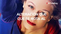 La trágica historia detrás de los ojos de Melissa Benoist